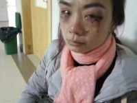 报警后打人者还在逍遥法外,希望各界好心人士帮帮她