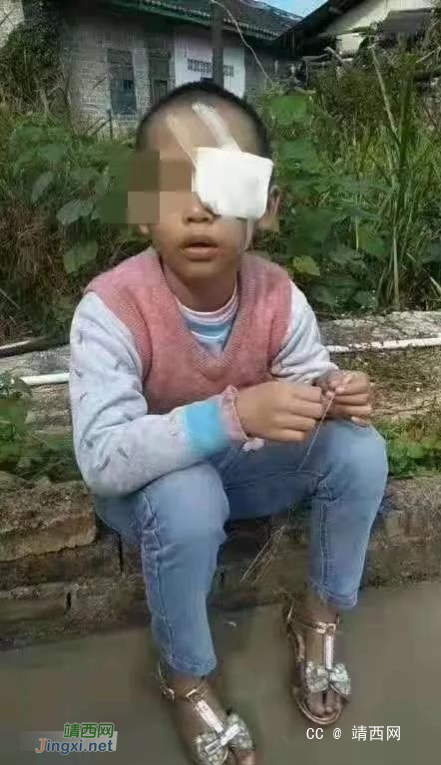 痛心！广西8岁女童遭养父毒打，被迫讨饭、睡厕所…… - 靖西网