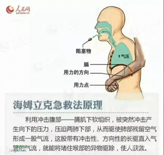 广西一6岁男童吃花生被呛住窒息，送到医院已无心跳！ - 靖西网