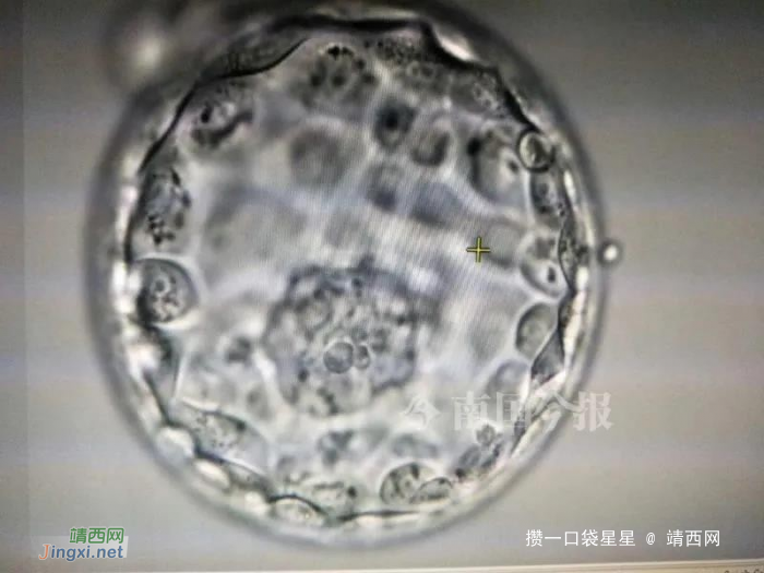 柳州47岁妈妈成功移植19年前的冷冻胚胎，喜得二宝 - 靖西网