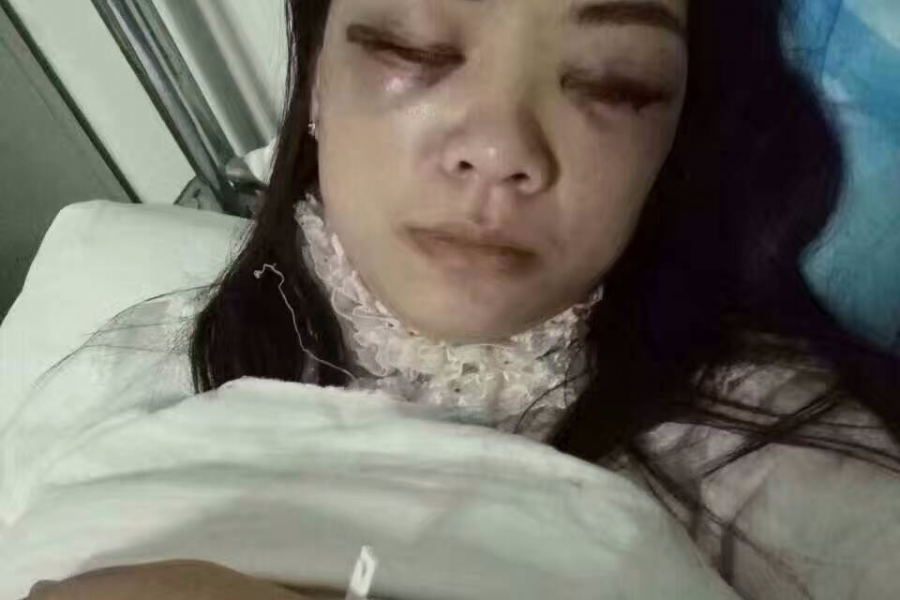 报警后打人者还在逍遥法外,希望各界好心人士帮帮她 - 靖西市·靖西网