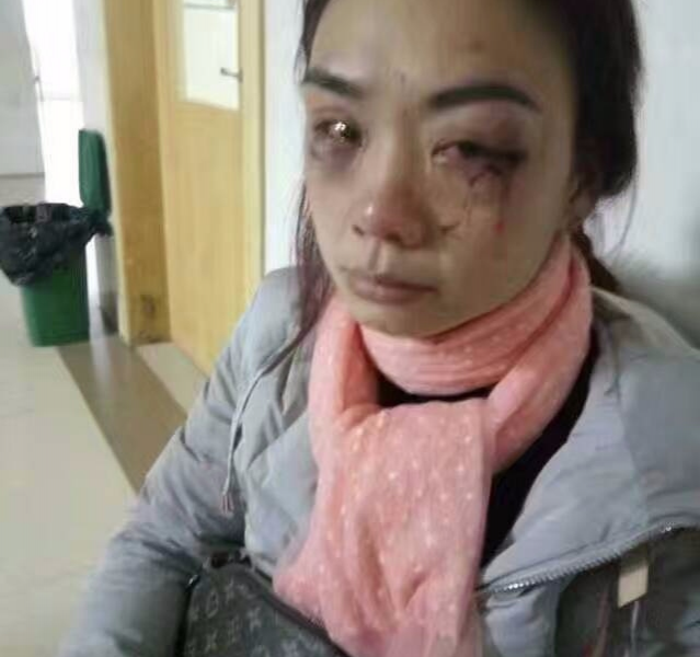 报警后打人者还在逍遥法外,希望各界好心人士帮帮她 - 靖西市·靖西网