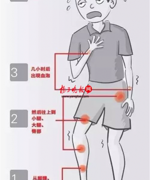 女子洗虾丧命内幕惊人，你还敢吃虾蟹吗？ - 靖西市·靖西网