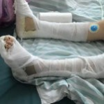 遭家暴跳楼女子被判离婚 - 靖西市·靖西网