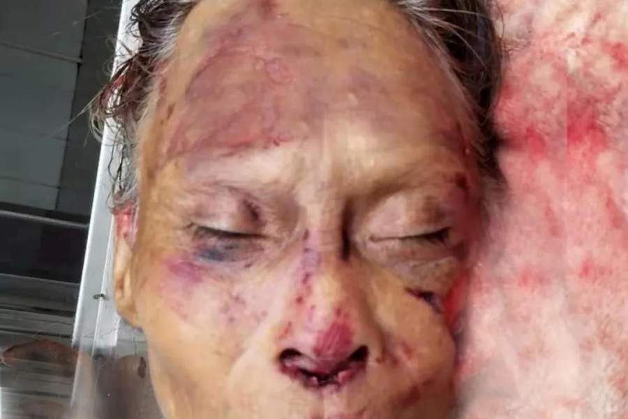 银百高速靖西段发生交通事故，警方发布认尸启事 - 靖西市·靖西网