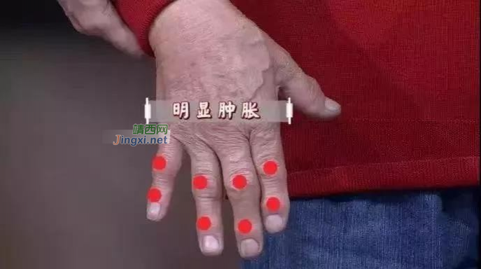 靖西人看过来，早上醒来，身体有这6种情况，可能是疾病信号！很多人还不当回事… - 靖西市·靖西网