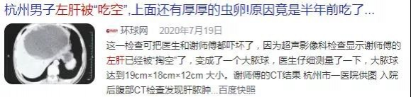 在外吃饭，带这2个字的菜千万别点！伤肝特狠还招癌，有人吃一次就中招 - 靖西市·靖西网