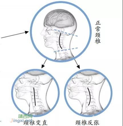 靖西人看过来咯。“高枕无忧”是真的吗？枕头最佳高度是多少？收好这份“安枕指南” - 靖西市·靖西网